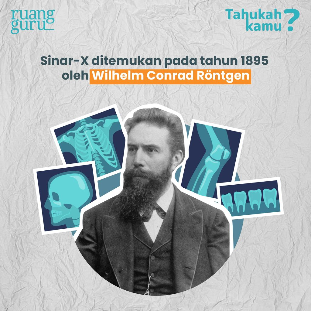 Apa Saja Peran Sinar X di Berbagai Bidang Kehidupan? Fisika Kelas 12